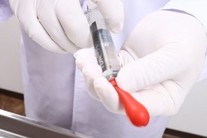 シリンジの目盛りでヒアルロン酸の量を確認している場面